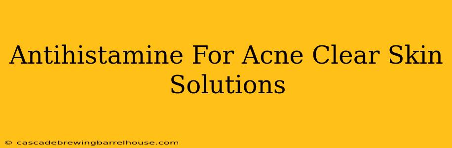 Antihistamine For Acne Clear Skin Solutions